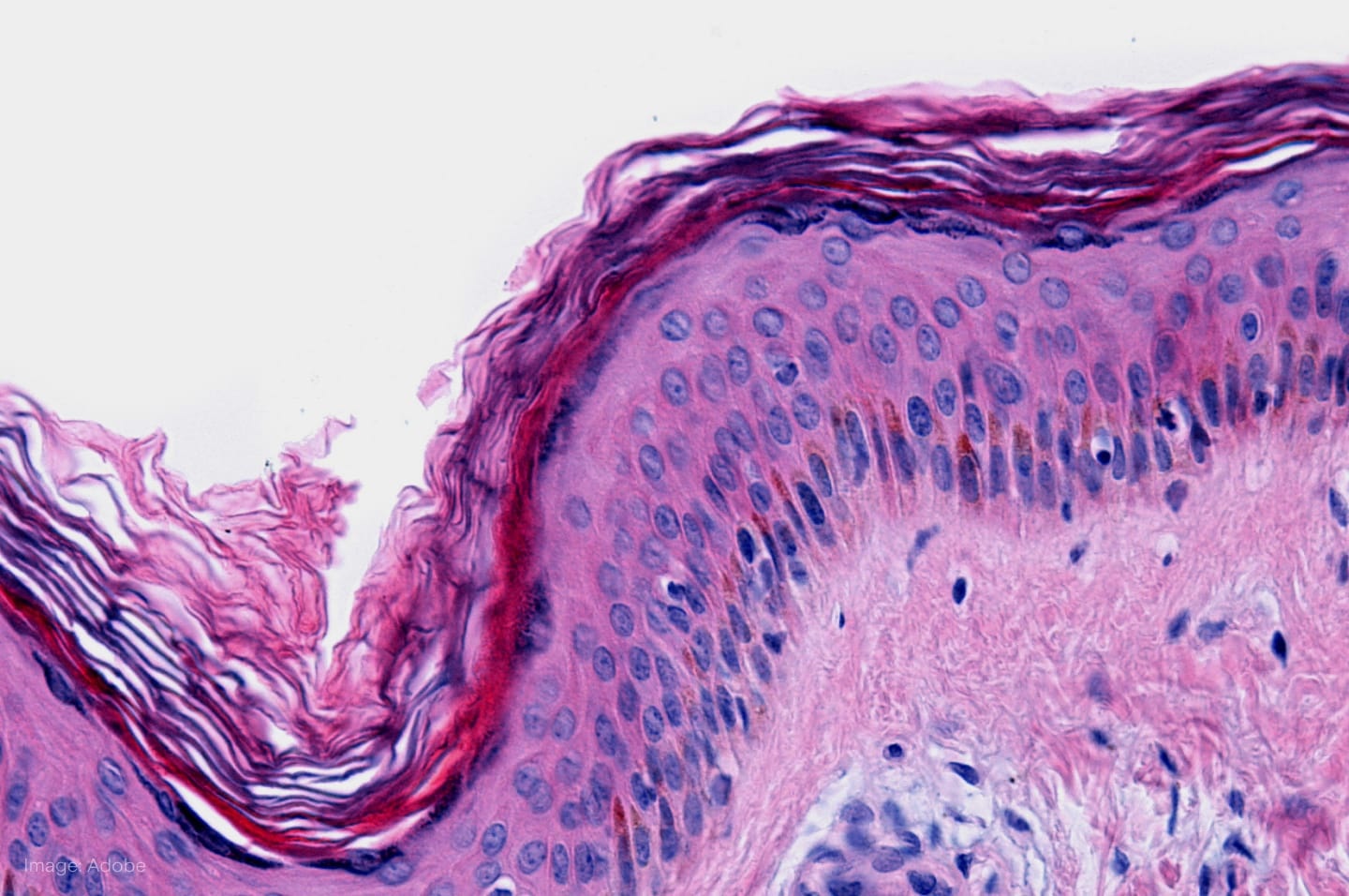 Polynovo_Featured.jpg